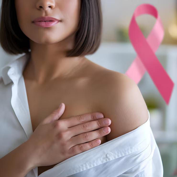 câncer de mama
